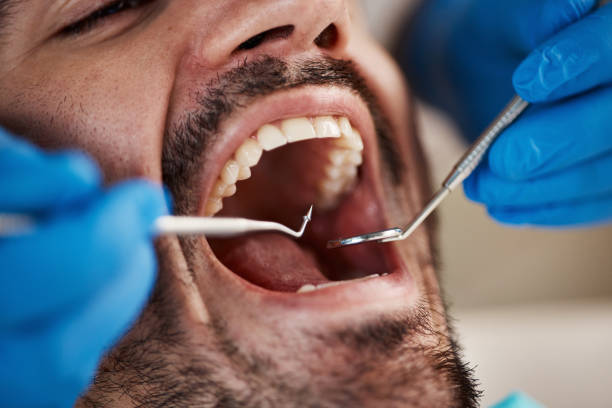 Best Emergency Denture Repair in Pontoon Beach, IL