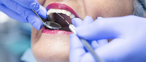 Best Emergency Denture Repair in Pontoon Beach, IL